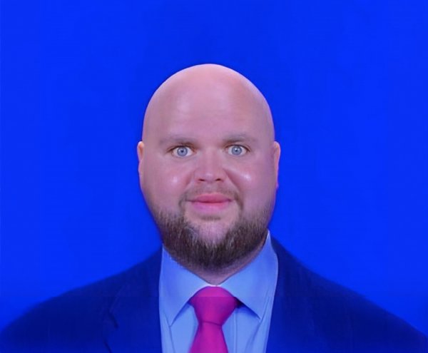 Bald J.D. Vance